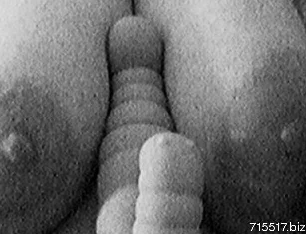 vilma